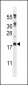 DSCR1L1 Antibody (N-term)